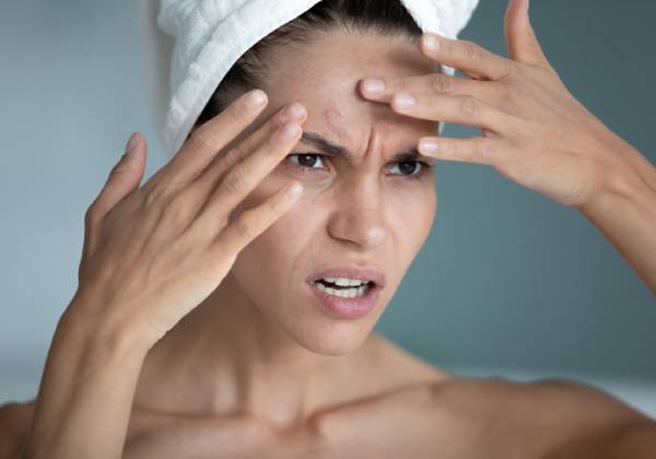 The Connection Between Stress and Skin Problems